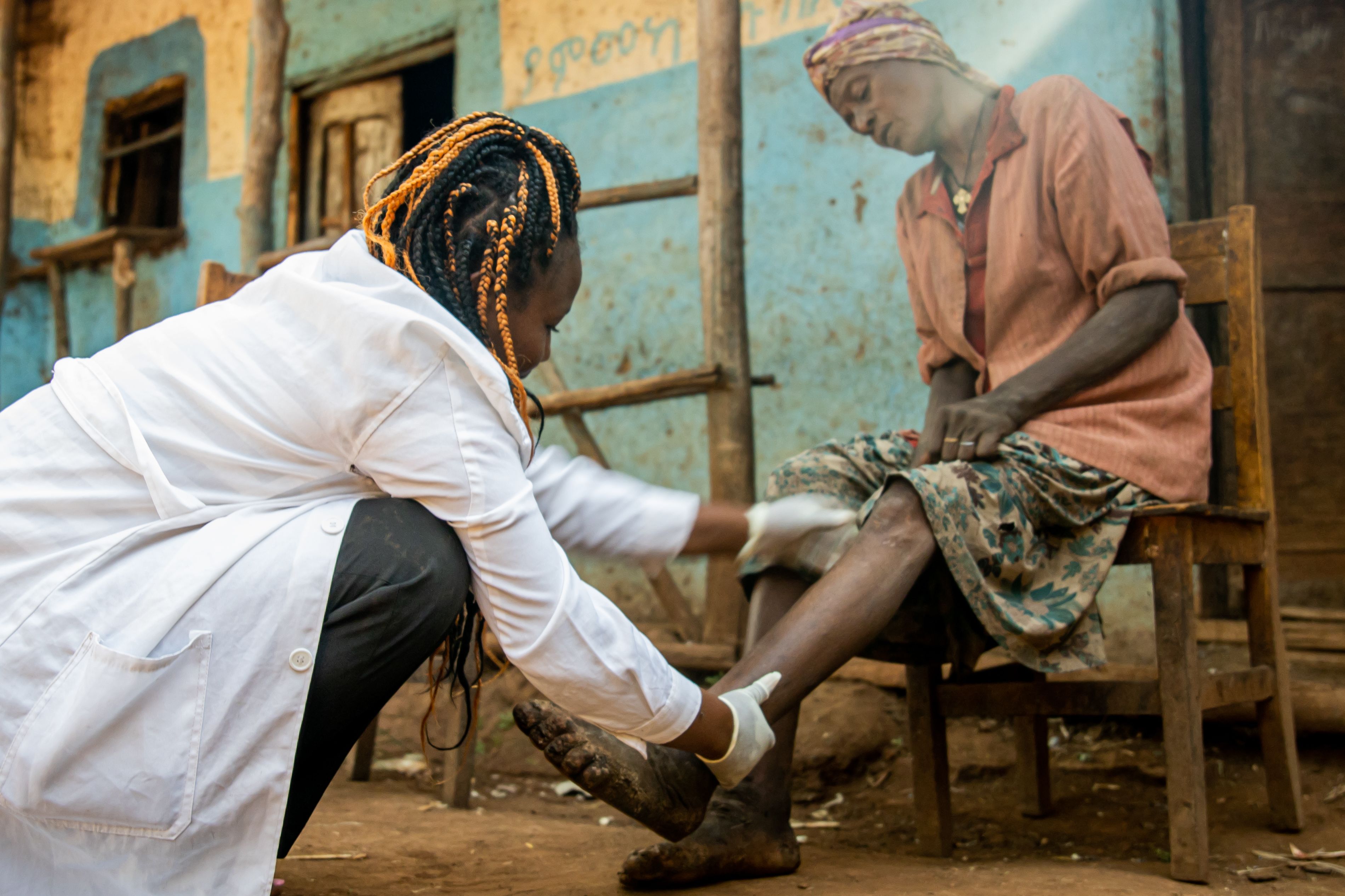 Healthcare worker examines legs of woman with podoconiosis